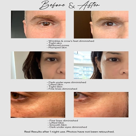 HADAKA - Nūvo Skin Micro Crystallized Elastic Fibre Eye Strips and Serum